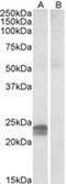 High mobility group protein HMG-I/HMG-Y antibody, AP23070PU-N, Origene, Western Blot image 