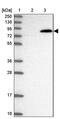 Ubiquitin carboxyl-terminal hydrolase 37 antibody, PA5-60939, Invitrogen Antibodies, Western Blot image 