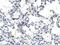 SNW Domain Containing 1 antibody, A03854, Boster Biological Technology, Immunohistochemistry paraffin image 