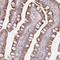 Spermatogenesis-associated serine-rich protein 1 antibody, HPA049722, Atlas Antibodies, Immunohistochemistry paraffin image 