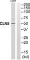 Ceroid-lipofuscinosis neuronal protein 5 antibody, PA5-39098, Invitrogen Antibodies, Western Blot image 