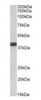 cAMP-dependent protein kinase catalytic subunit alpha antibody, orb334061, Biorbyt, Western Blot image 