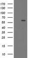 Cytochrome P450 Family 17 Subfamily A Member 1 antibody, TA503415S, Origene, Western Blot image 