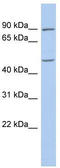 PLAG1 Zinc Finger antibody, TA335811, Origene, Western Blot image 