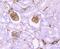 S100 Calcium Binding Protein A10 antibody, NBP2-67122, Novus Biologicals, Immunohistochemistry paraffin image 