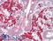 Laforin antibody, LS-B8862, Lifespan Biosciences, Immunohistochemistry frozen image 