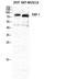 Fibroblast Activation Protein Alpha antibody, STJ95609, St John