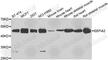 Eukaryotic Translation Elongation Factor 1 Alpha 2 antibody, A7327, ABclonal Technology, Western Blot image 