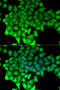 RNA Guanylyltransferase And 5'-Phosphatase antibody, 22-217, ProSci, Immunofluorescence image 