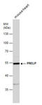 Prolargin antibody, GTX123359, GeneTex, Western Blot image 