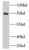 Proprotein convertase subtilisin/kexin type 7 antibody, FNab06226, FineTest, Western Blot image 
