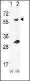 Glucokinase antibody, PA5-15073, Invitrogen Antibodies, Western Blot image 