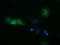 DHEA-ST antibody, GTX83539, GeneTex, Immunocytochemistry image 