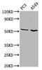 ETS Variant 5 antibody, LS-C680428, Lifespan Biosciences, Western Blot image 