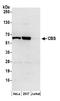 Cystathionine beta-synthase antibody, A304-780A, Bethyl Labs, Western Blot image 