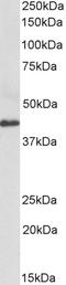 Acc1 antibody, TA329093, Origene, Western Blot image 