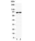 Discs Large MAGUK Scaffold Protein 4 antibody, R31419, NSJ Bioreagents, Western Blot image 