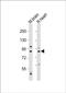 Calpain-5 antibody, PA5-72245, Invitrogen Antibodies, Western Blot image 