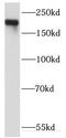 Kinase D-interacting substrate of 220 kDa antibody, FNab04549, FineTest, Western Blot image 