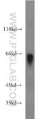 HPX antibody, 15736-1-AP, Proteintech Group, Western Blot image 