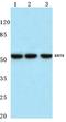 Keratin 8 antibody, AP06206PU-N, Origene, Western Blot image 