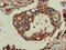 TPD52 Like 2 antibody, LS-C679870, Lifespan Biosciences, Immunohistochemistry paraffin image 