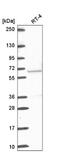 ETS Variant 5 antibody, NBP2-55689, Novus Biologicals, Western Blot image 