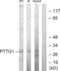 PTTG1 Regulator Of Sister Chromatid Separation, Securin antibody, LS-C118744, Lifespan Biosciences, Western Blot image 