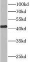Ataxin 3 Like antibody, FNab00742, FineTest, Western Blot image 