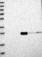 Rho GTPase Activating Protein 33 antibody, NBP1-92421, Novus Biologicals, Western Blot image 