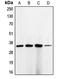 Cyclin Dependent Kinase 1 antibody, LS-C351970, Lifespan Biosciences, Western Blot image 