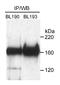 hRAD50 antibody, A300-184A, Bethyl Labs, Immunoprecipitation image 