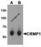Dihydropyrimidinase-related protein 1 antibody, 3623, ProSci, Western Blot image 