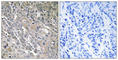 Cdc42 Guanine Nucleotide Exchange Factor 9 antibody, abx014827, Abbexa, Western Blot image 