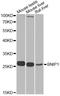 BCL2 Interacting Protein 1 antibody, STJ29404, St John