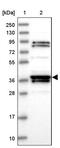 Reticulon 4 Interacting Protein 1 antibody, PA5-57625, Invitrogen Antibodies, Western Blot image 