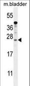 Shisa Like 1 antibody, LS-C165501, Lifespan Biosciences, Western Blot image 