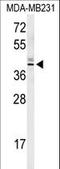 Kelch Domain Containing 2 antibody, LS-C165548, Lifespan Biosciences, Western Blot image 
