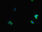 Latent Transforming Growth Factor Beta Binding Protein 4 antibody, LS-C678531, Lifespan Biosciences, Immunofluorescence image 