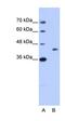 GIPC PDZ Domain Containing Family Member 1 antibody, orb330137, Biorbyt, Western Blot image 