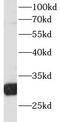 Ribosomal Protein S3 antibody, FNab07477, FineTest, Western Blot image 