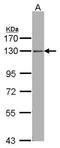 Rho/Rac Guanine Nucleotide Exchange Factor 18 antibody, TA308388, Origene, Western Blot image 