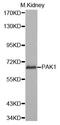 P21 (RAC1) Activated Kinase 1 antibody, MBS127396, MyBioSource, Western Blot image 