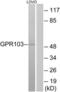 Pyroglutamylated RFamide peptide receptor antibody, LS-C120944, Lifespan Biosciences, Western Blot image 