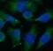 Dihydrofolate Reductase antibody, FNab02365, FineTest, Immunofluorescence image 