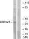 Olfactory Receptor Family 10 Subfamily Z Member 1 antibody, TA316091, Origene, Western Blot image 