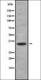Paired Like Homeobox 2B antibody, orb338526, Biorbyt, Western Blot image 