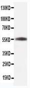 Tubulin Beta 1 Class VI antibody, MA1112, Boster Biological Technology, Western Blot image 