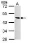 Histone Deacetylase 8 antibody, PA5-29885, Invitrogen Antibodies, Western Blot image 