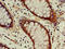 Sterol O-Acyltransferase 1 antibody, LS-C677045, Lifespan Biosciences, Immunohistochemistry paraffin image 